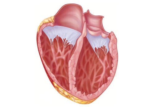 Hvad du bør vide om dilateret kardiomyopati