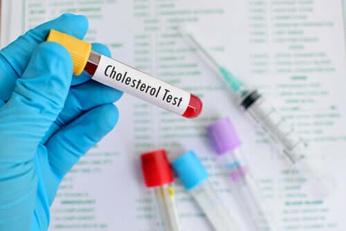 HDL- og LDL-kolesterol: Alt, hvad du behøver at vide