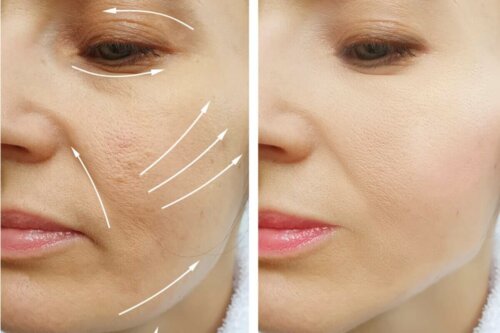 Feminisering af ansigtet