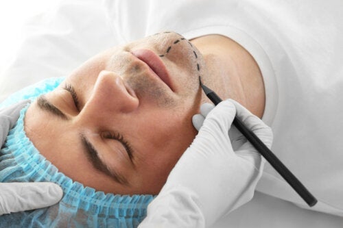 Kirurgi til feminisering af ansigtet: Hvad er det, og hvad er risikoen?