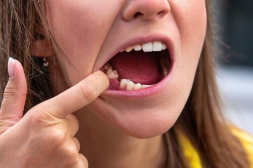 Kvinde mangler en tand i munden