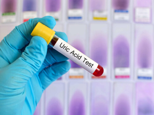 Test af urinsyre