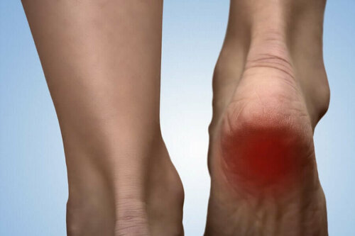 Hælspore forårsager, at fødder gør meget ondt