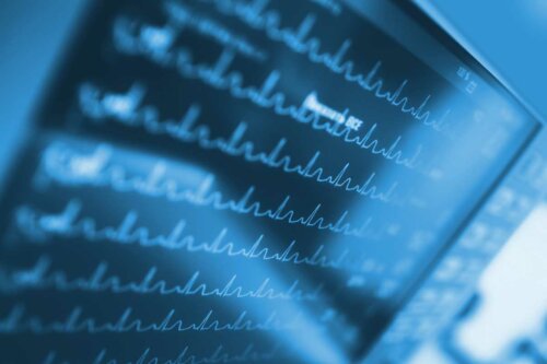 Måling af hjerterytme