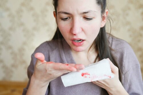 Kvinde med næseblod, hvilket er en af de gængse farver på slim