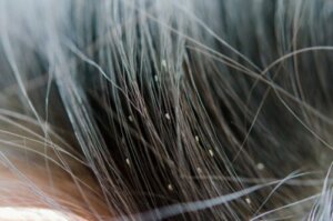 Sådan kan du identificere hovedlus og deres spor