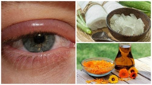 Du kan bekæmpe øjeninfektioner med en af disse 9 løsninger
