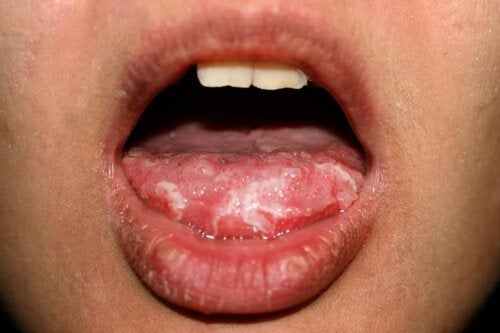Din tunge kan afsløre dine følelser og helbred