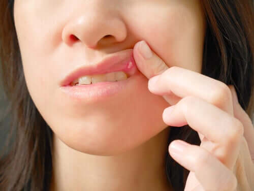 Årsager til sår i munden og behandlinger