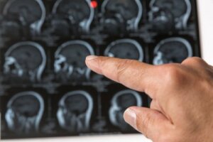 Kan knuder på hovedet være tumorer?