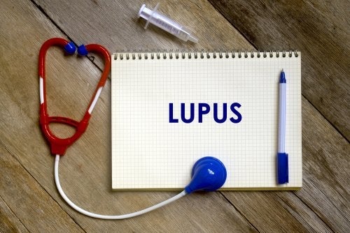 Hvad er de forskellige risikofaktorer for lupus?