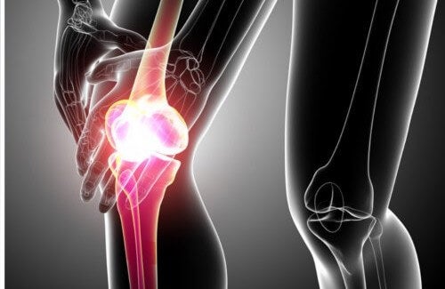 Tips til naturligt at lindre symptomer på senebetændelse