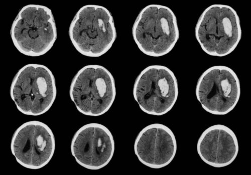 Undersøgelse af knuder på hovedet