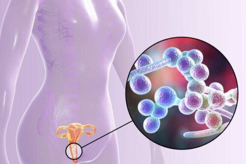 En urinvejsinfektion kan forårsage vaginal lugt
