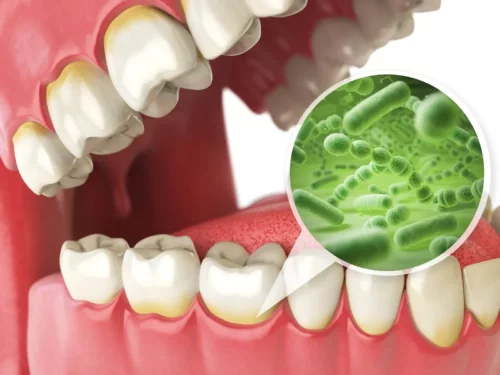 Bakterier i mund gør det vigtigt at børste tænder