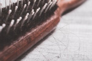 Hvordan man kan behandle alopecia naturligt