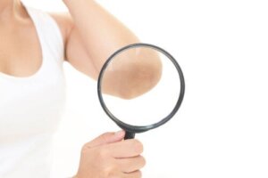 Hvordan man naturligt slipper af med mørke albuer og knæ