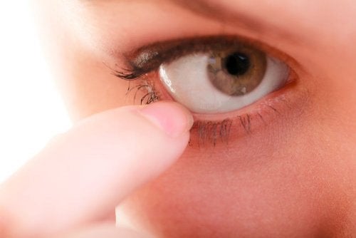 10 naturlige midler mod kløende øjne