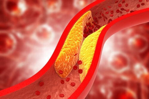 Passer det, at den ketogene diæt kan øge kolesterolniveauet?