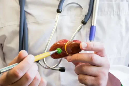 Læge holder en model af et organ i hånden