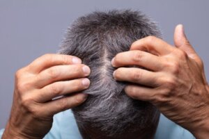 6 æteriske olier, der hjælper med at bekæmpe skæl