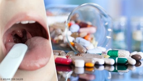 Behandling af akut halsbetændelse