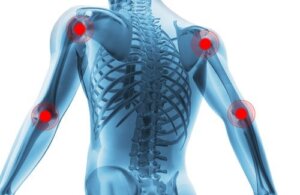 Hvordan man behandler slitage af leddene