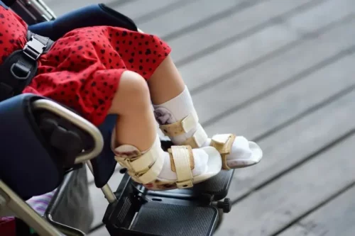 Barn i kørestol lider af en af de gængse typer af cerebral parese