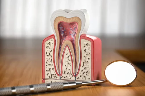 Illustration af tandens indre inklusiv tandnerven