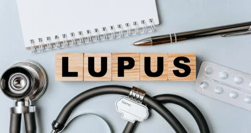 Diagnose af lupus