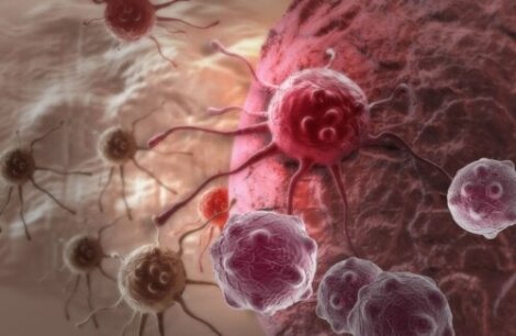Eksperimentel medicin mod colorektal kræft giver remission hos alle patienter i undersøgelsen
