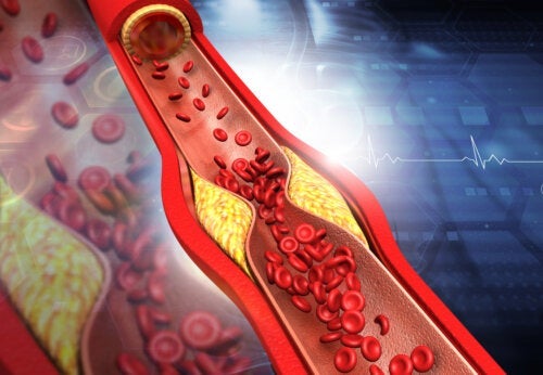 Symptomer og tips til at hæve HDL-kolesterolniveauet