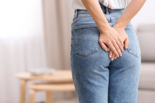Kvinde meed smerter ved anus har brug for en behandling af hæmorider