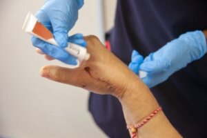 De mest almindeligt anvendte typer af helbredende cremer og salver