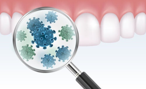 Alt, hvad du skal vide om bakteriel tandplak