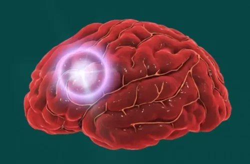 Placeringen af hukommelsen i hjernen repræsenterer ansigtsblindhed