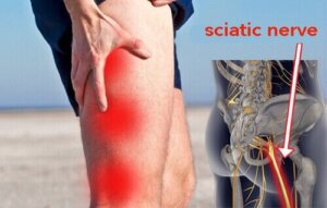 Medicin mod smerter i iskiasnerven