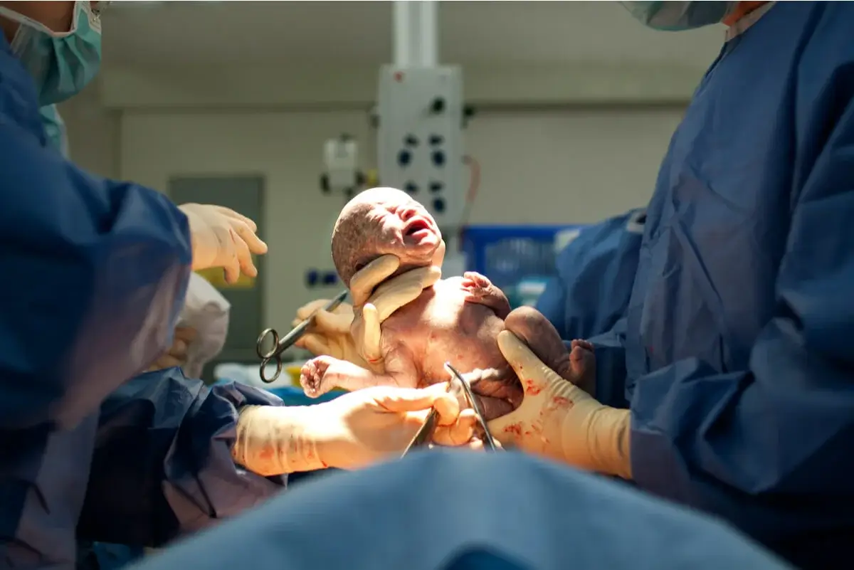 Nyfødt baby født ved kejsersnit
