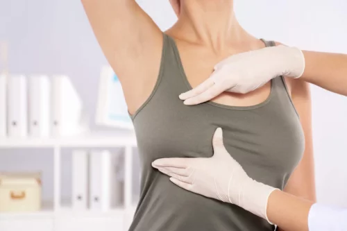 Kvindes bryst undersøges grundet skæve bryster