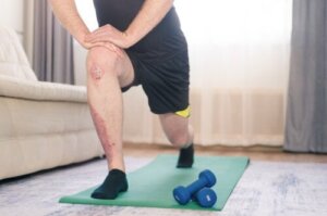 Fordelene ved fysisk træning mod psoriasis