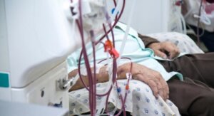 Hvad er terapeutisk aferese?