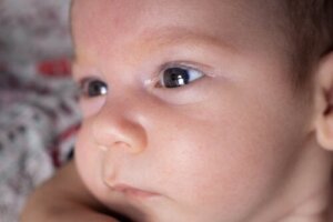 Aniridi eller fravær af iris: Hvorfor forekommer det?