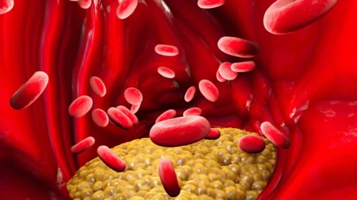 Illustration af kolesterol i blodbane