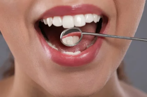 En kvindes tænder undersøges