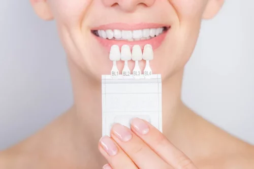 Kvinde vurderer tandblegning