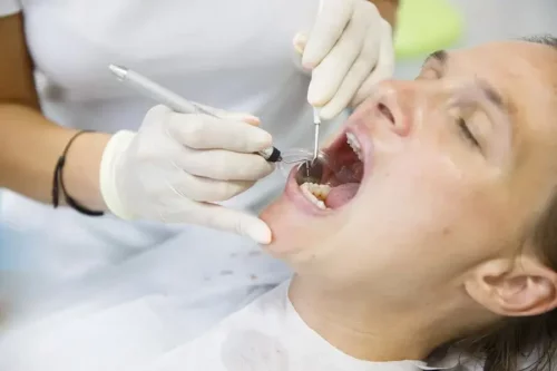 Tandlæge behandler med syreætsning