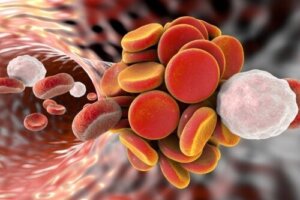 Antifosfolipidsyndrom: Årsager, symptomer og behandlinger