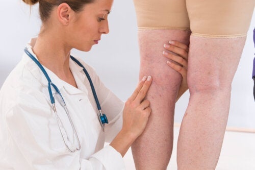 11 symptomer på dårligt blodomløb i ben og fødder