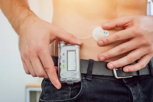 Pumpe til at måle blodsukker og administrere insulin