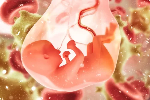 Baby ligger i fostervand i maven, hvilket repræsenterer problemer med fostervand